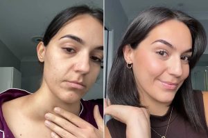 26-Year-Old Woman Experienced Severe Itching but Was Told 'It's Just One of Those Things.' She Then Self-Diagnosed Her Cancer.