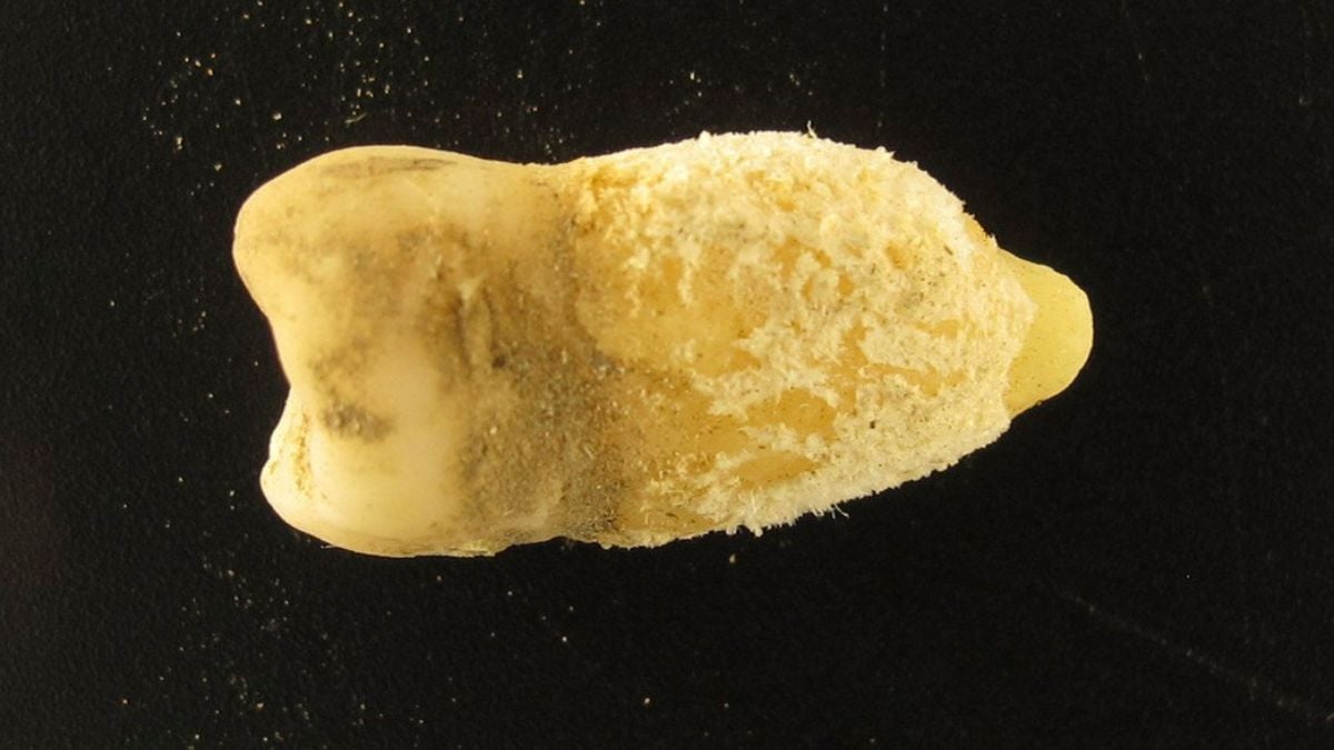 A Tooth from a Bolivian Mummy Is Changing Our Understanding of Scarlet Fever