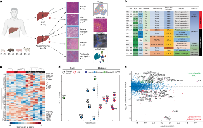 A detailed map of the healthy human liver from living donors
