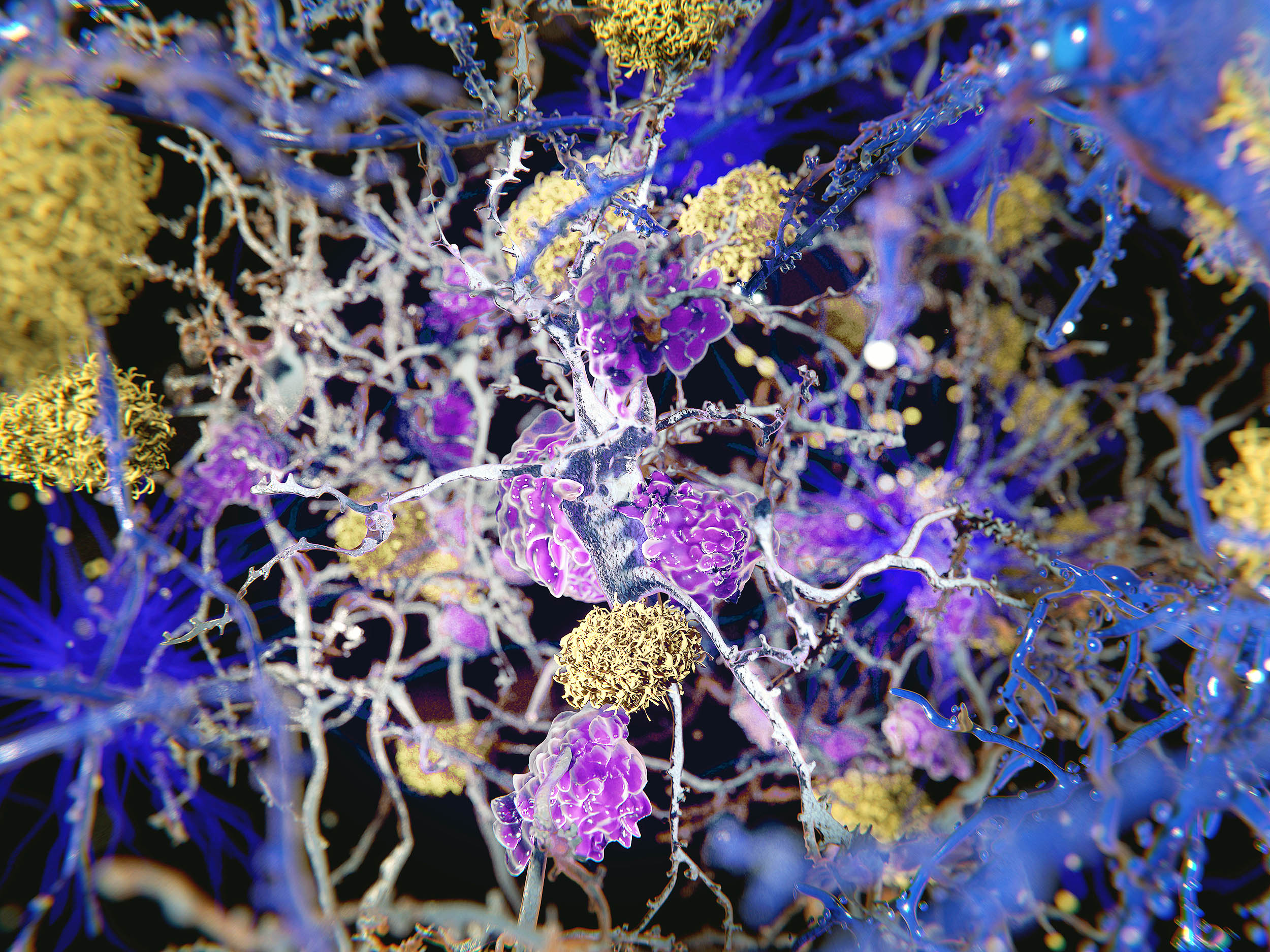 Alzheimer's could begin with inflammation in body tissues rather than in the brain.