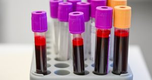 Are blood tests for cancer screening nearing widespread use?