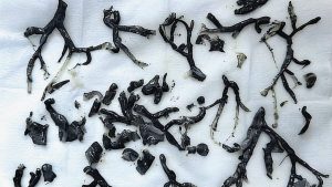 Black Substance Discovered in Man's Lungs Reveals a More Troubling Aspect of Wildfire Smoke