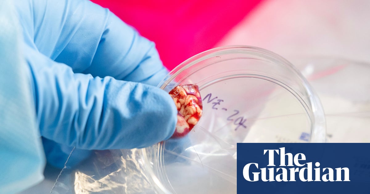 CDC pauses testing for multiple infectious diseases due to lack of staff