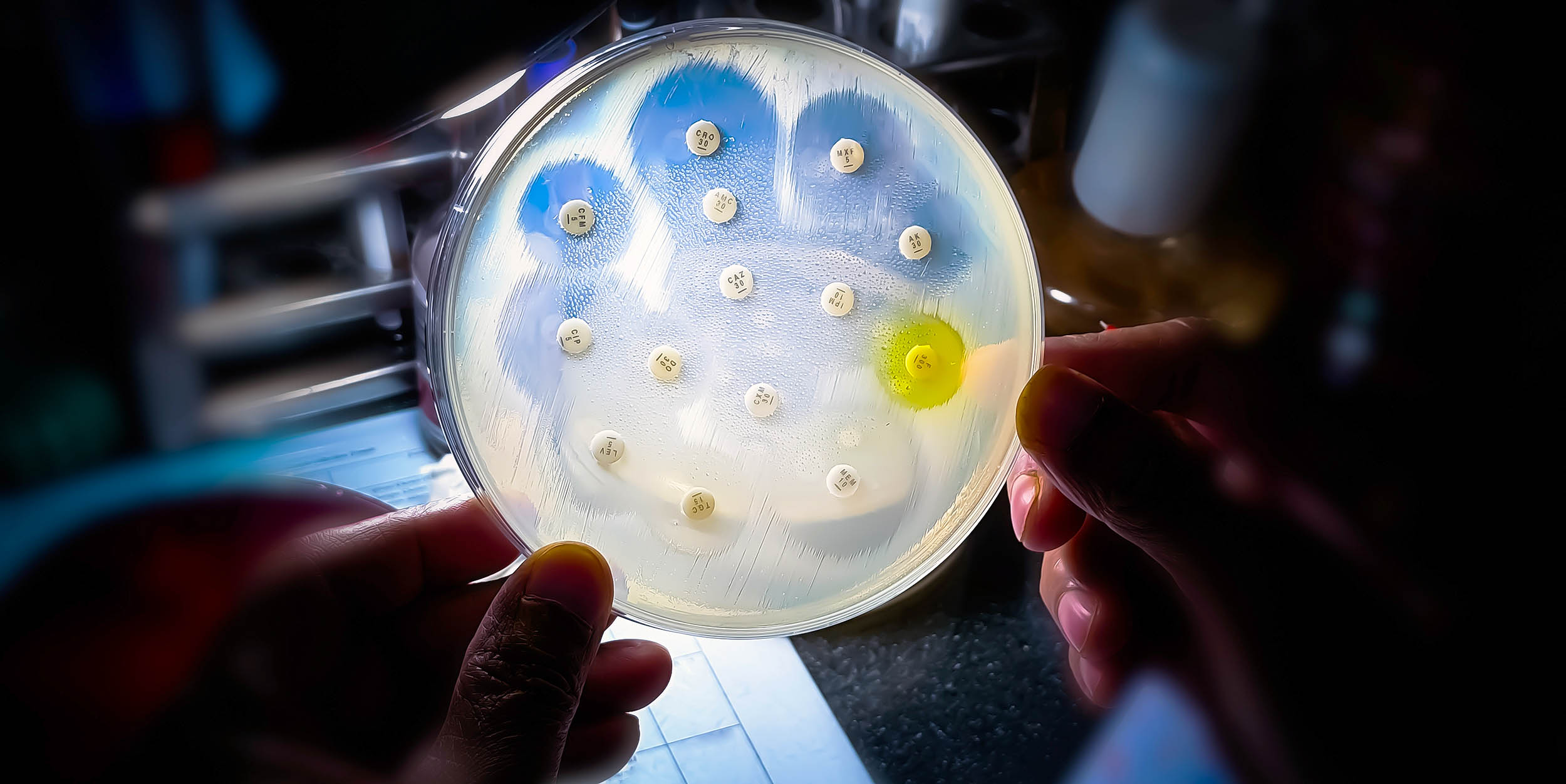 Common infections are losing their effectiveness against antibiotics