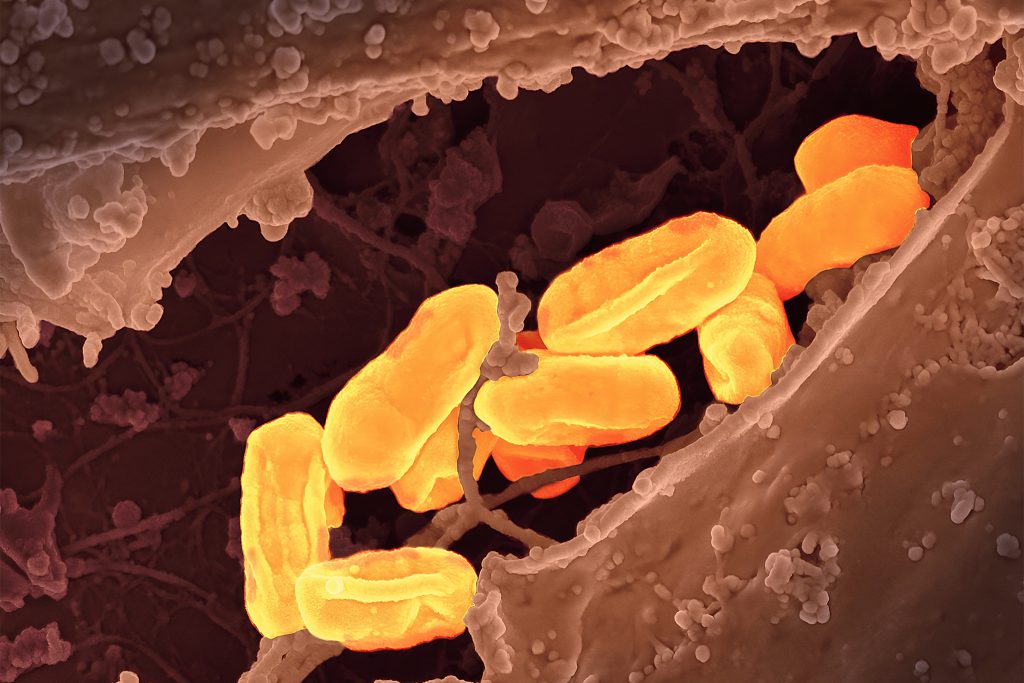 Deadly illness 'ages like the plague' reaches all-time high in California