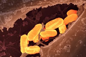 Deadly illness 'ages like the plague' reaches all-time high in California