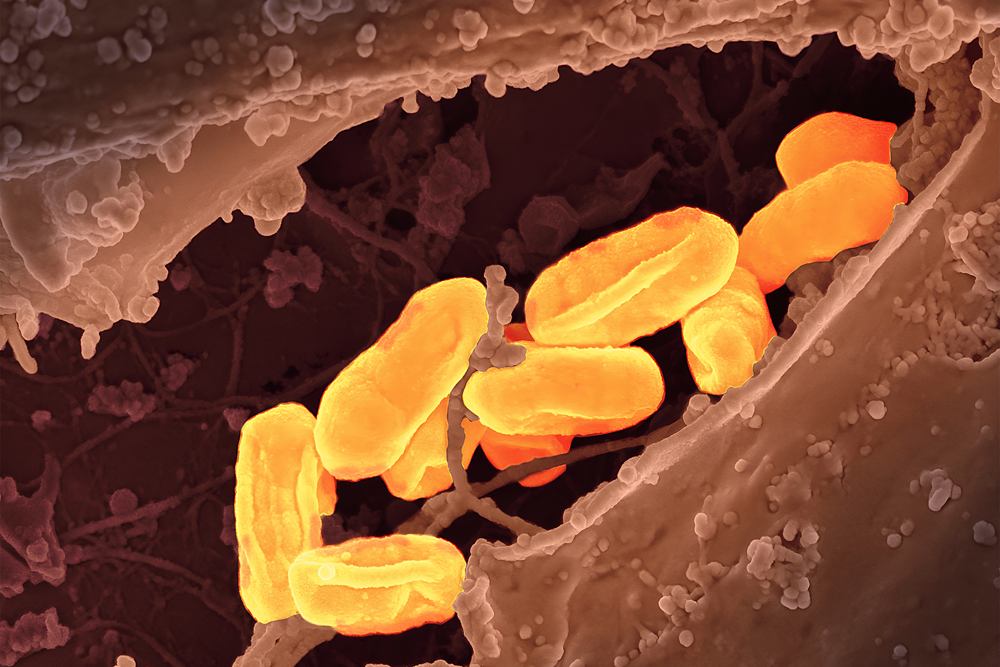 Deadly illness 'ages like the plague' reaches all-time high in California