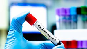 Find Out Which Carb Cardiologists Suggest for Reducing Cholesterol Levels