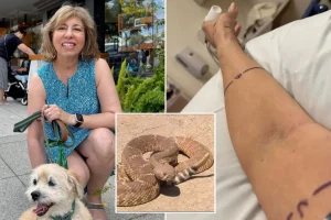 Graphic images reveal the consequences of a rattlesnake bite — as the victim shares their experience.