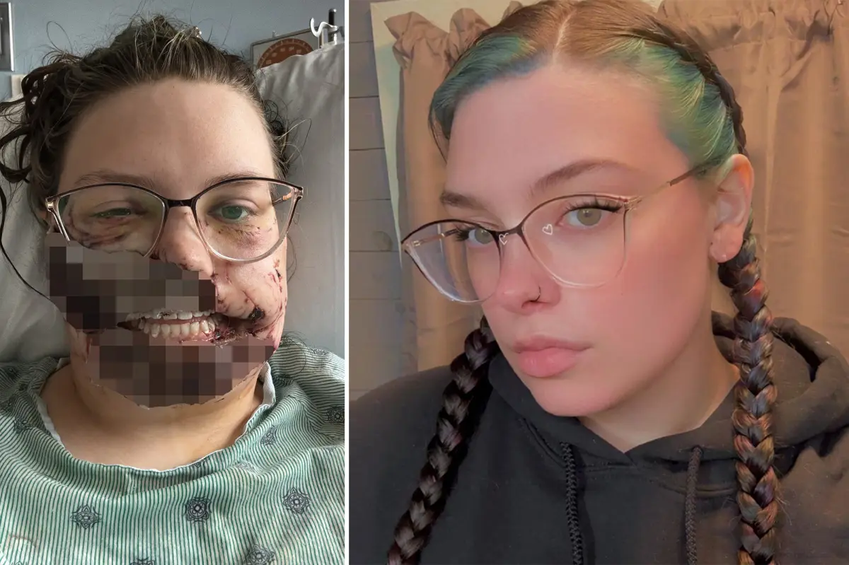 Illinois mother injured by rescue dog after having a seizure