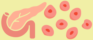 Implantable Islet Cells May Regulate Type 1 Diabetes