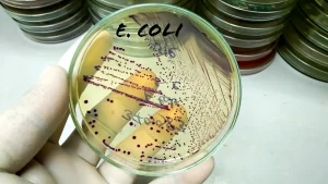 Indiana University researcher receives prison time for bringing E. coli into the US