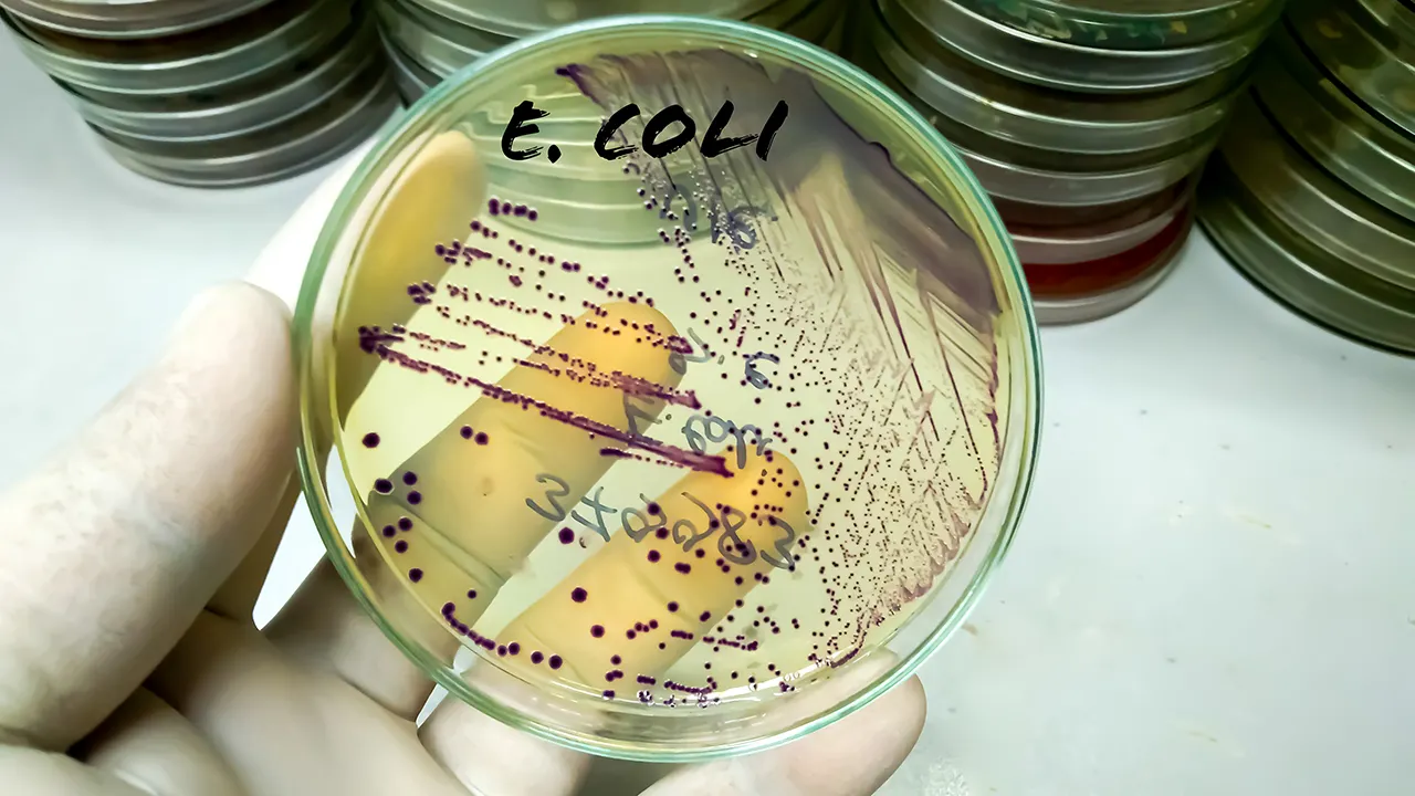 Indiana University researcher receives prison time for bringing E. coli into the US