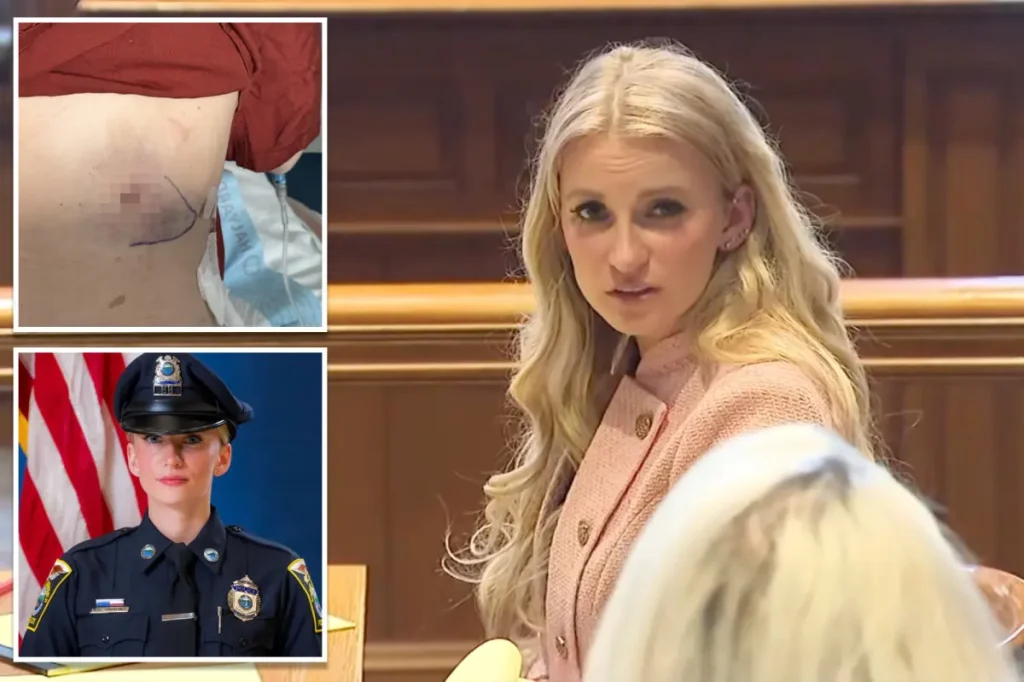 Kelsey Fitzsimmons reveals a detailed image of her injury from being shot by another officer while preparing to sue the town.