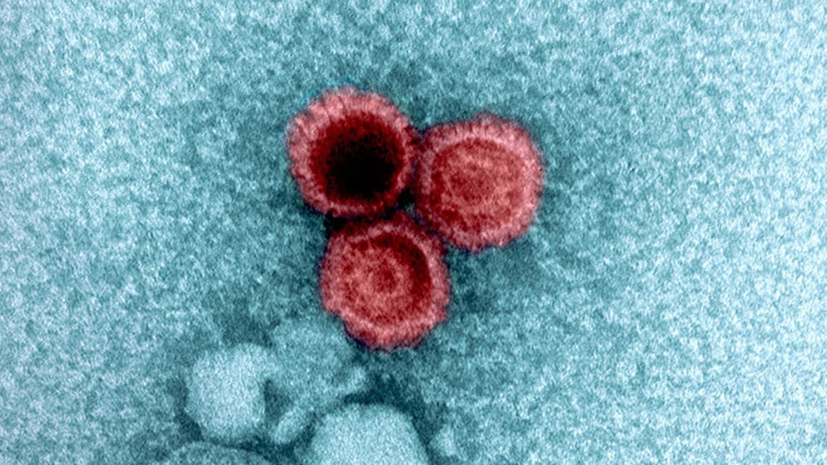 Large Research Uncovers Why Certain Viruses Remain Hidden in Your Body Permanently