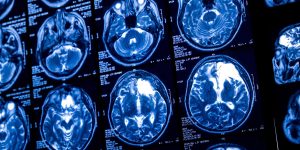 Light drinking as we age is associated with decreased blood flow to the brain and thinner brain tissue.