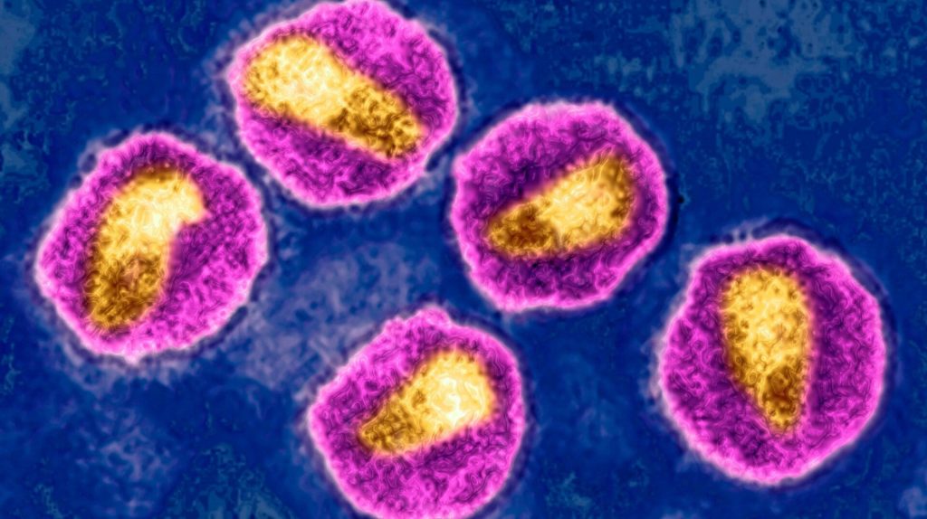 Man in Norway Healed of HIV Using His Brother's Stem Cells