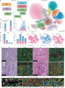 Mapping of diabetic kidney disease highlights a subgroup rich in B cells