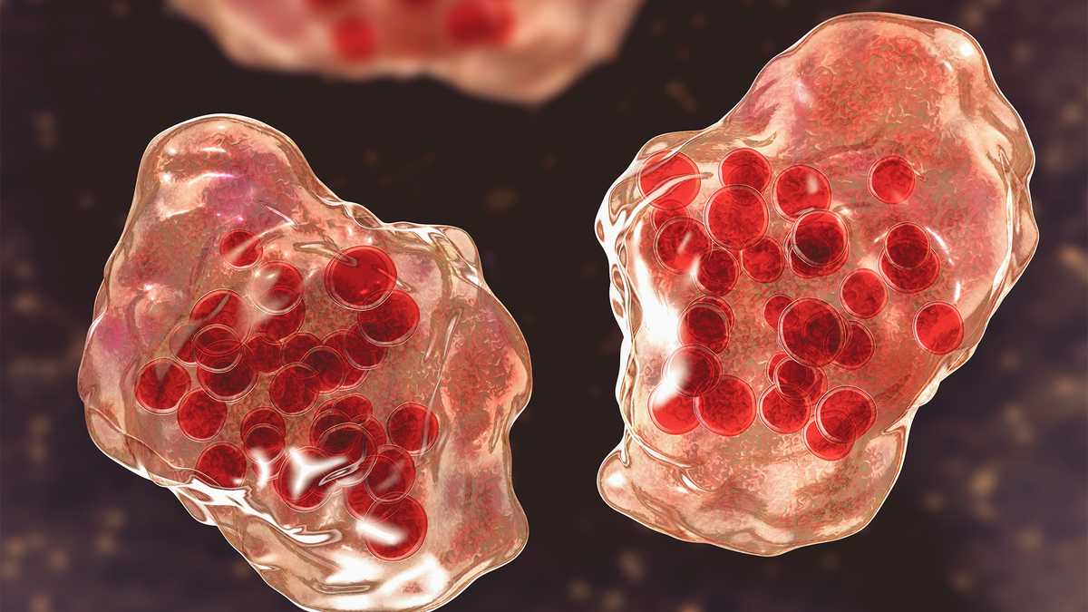 Measles case reported in Maryland resident who traveled recently