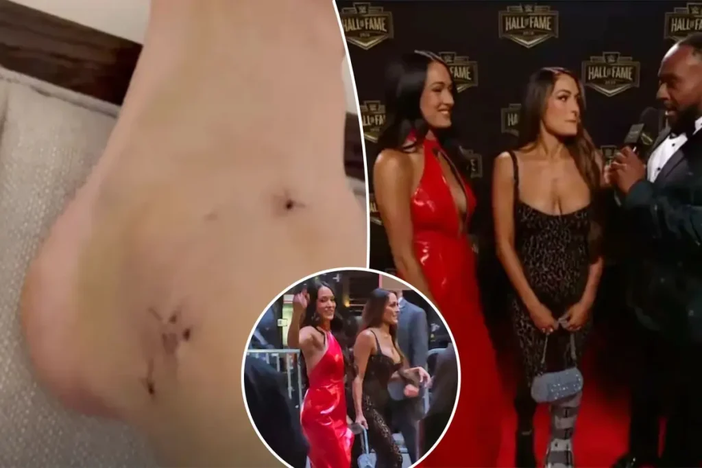 Nikki Bella shares picture of severe ankle injury