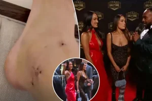 Nikki Bella shares picture of severe ankle injury