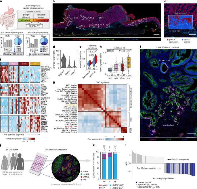 Oncofetal plasticity is widespread in early colorectal cancers.