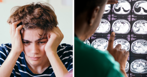 Online Users Split Over Study Showing Habit of 18 Million Americans May Lead to Lasting Brain Injury