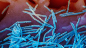 RSV continues to spread, leading states to lengthen the vaccination timeframe.