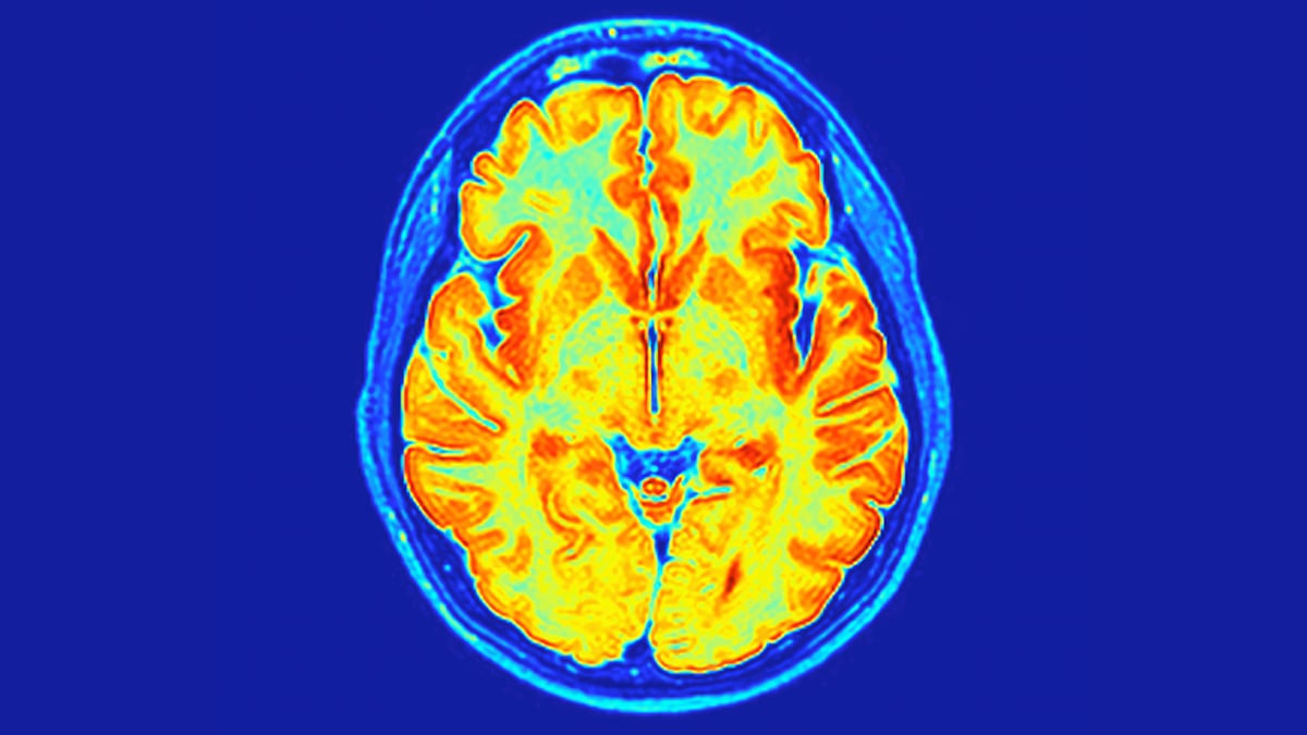 Researchers Discover a New Neurodevelopmental Disorder Embedded in Our Genes