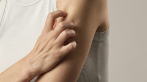 Shingles vaccines can help protect you from a painful condition.