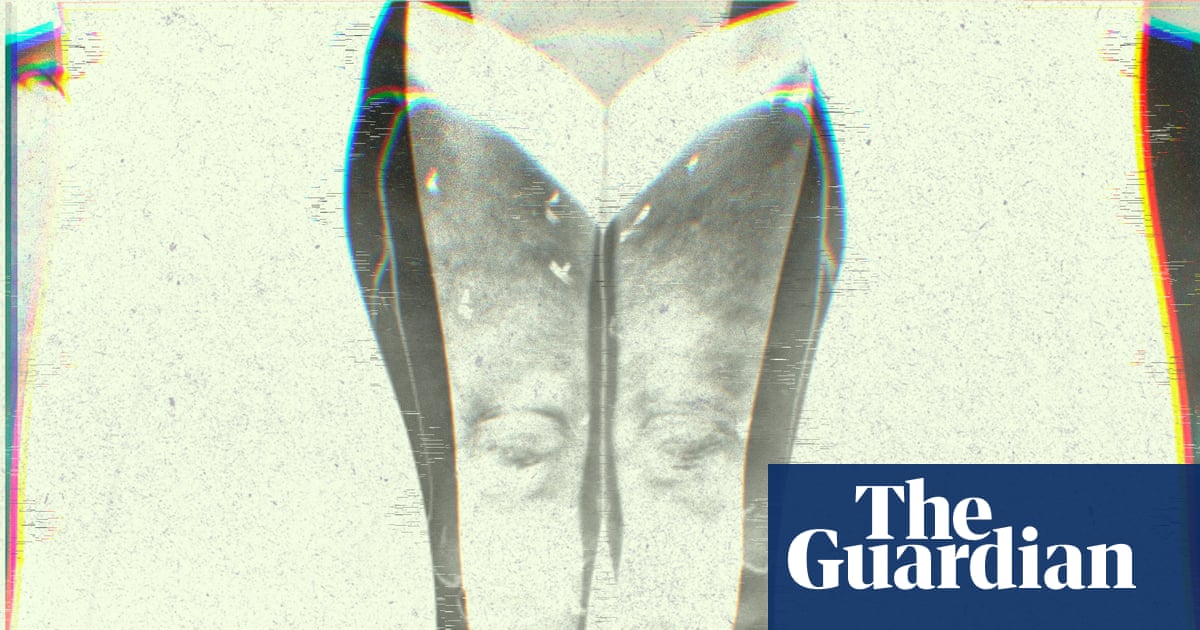 Swollen legs, painful heaviness, bumpy skin: what is lipedema?