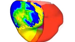 To correct a patient’s uneven heartbeat, doctors initially examined its digital counterpart.