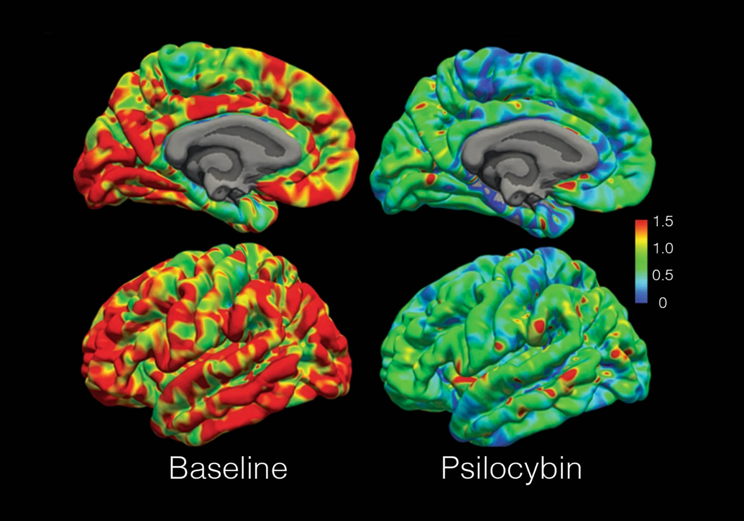 Various psychedelics produce nearly identical brain wave patterns