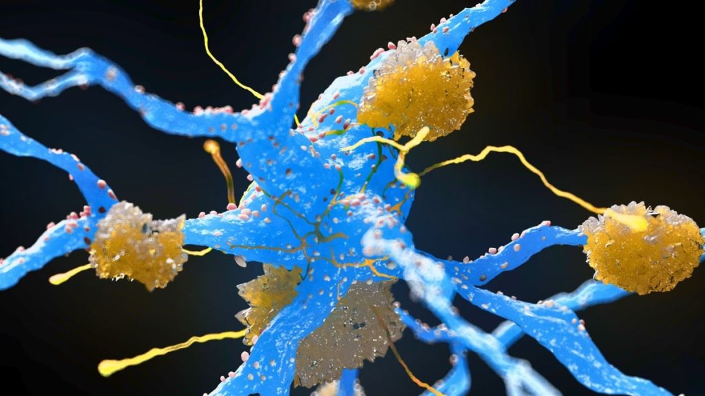 Weight-loss medications might help decrease the accumulation of Alzheimer's proteins, a significant review shows.