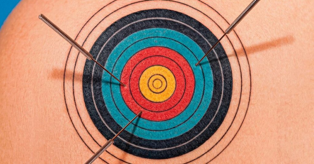 What Is Dry Needling and Is It Effective?