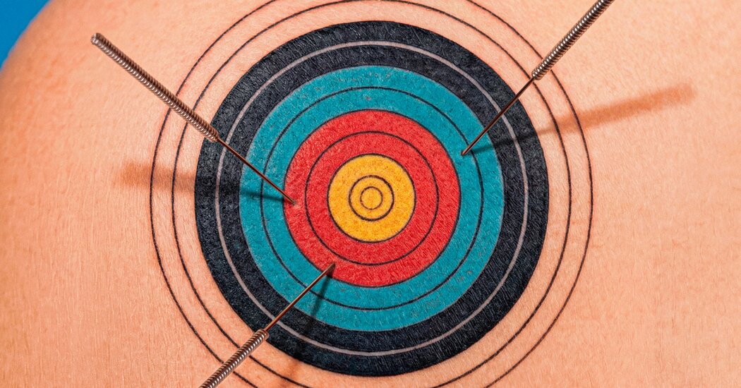 What Is Dry Needling and Is It Effective?