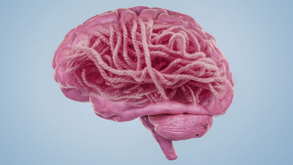 What’s the connection between Alzheimer’s disease and amyloid?