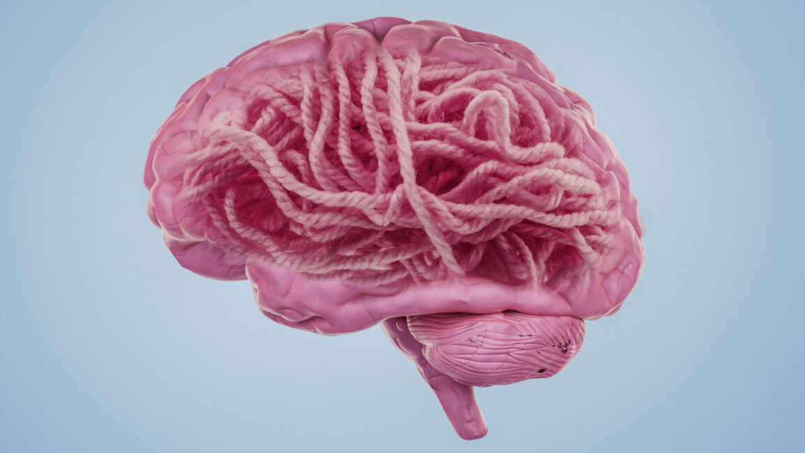 What’s the connection between Alzheimer’s disease and amyloid?