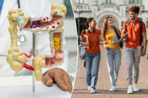 Worrisome increase in colon cancer deaths focused in a specific group