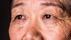 Your Eyesight May Reveal Dementia Risk 12 Years Ahead of Diagnosis, Research Indicates