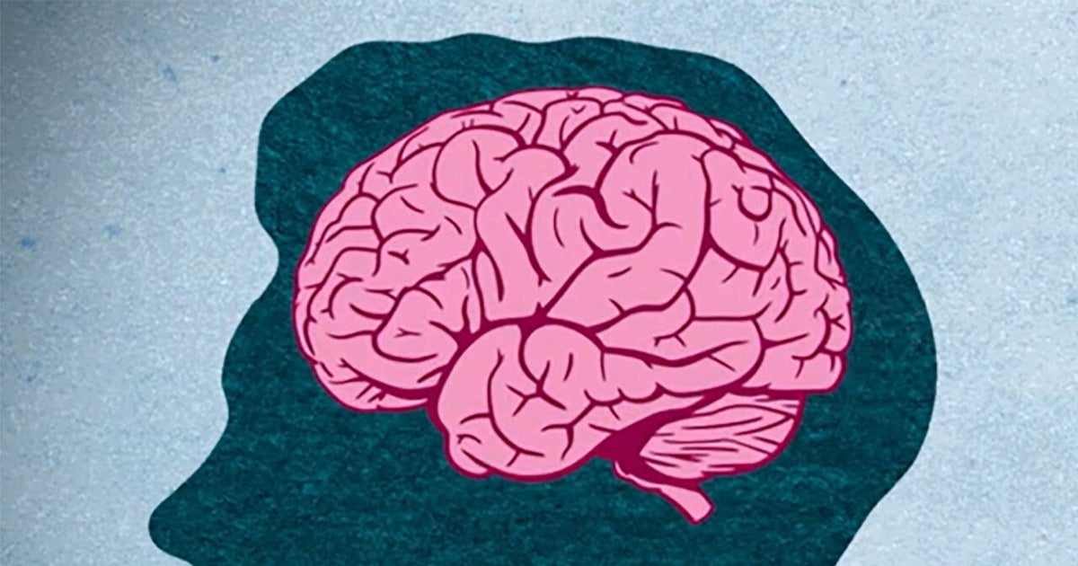 A resource to assist in managing dementia