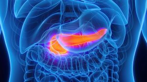 AI Can Detect Pancreatic Cancer Years Before It Is Diagnosed
