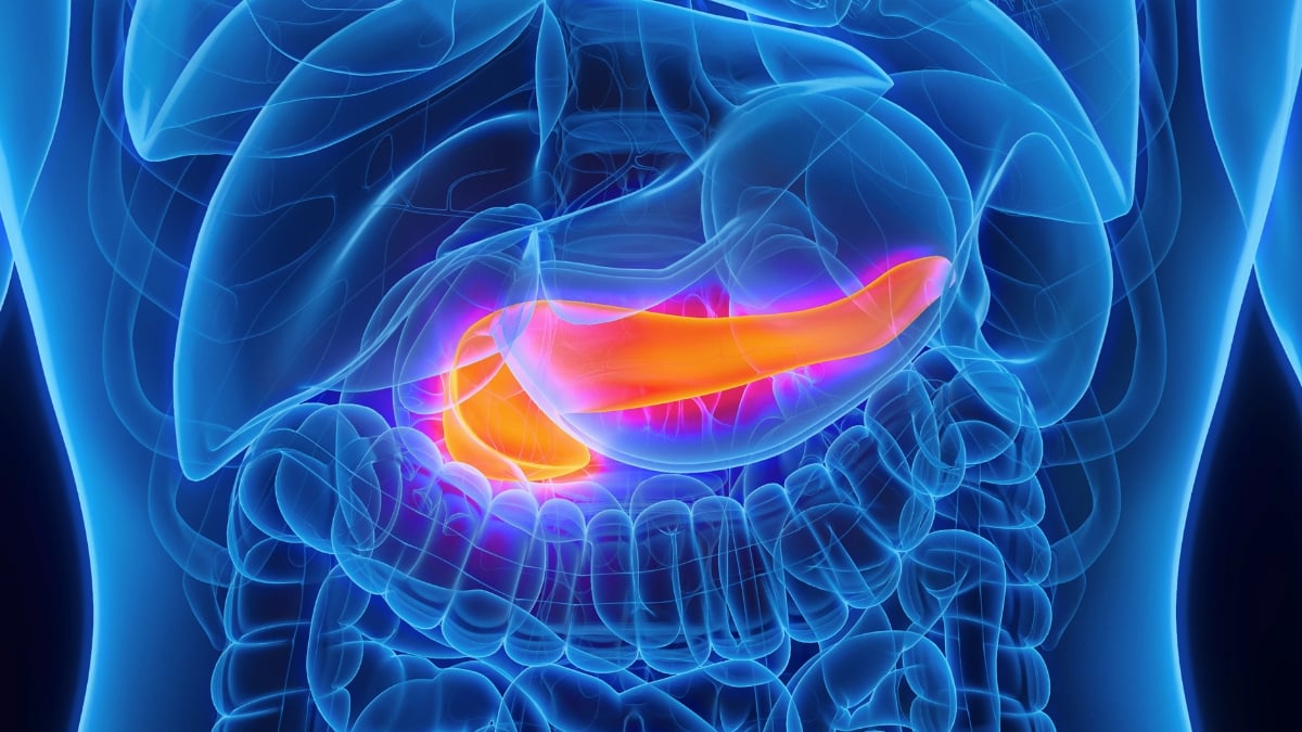 AI Can Detect Pancreatic Cancer Years Before It Is Diagnosed
