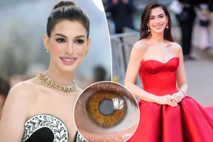 Anne Hathaway's hidden medical issue for ten years caused her significant vision loss during her 30s.