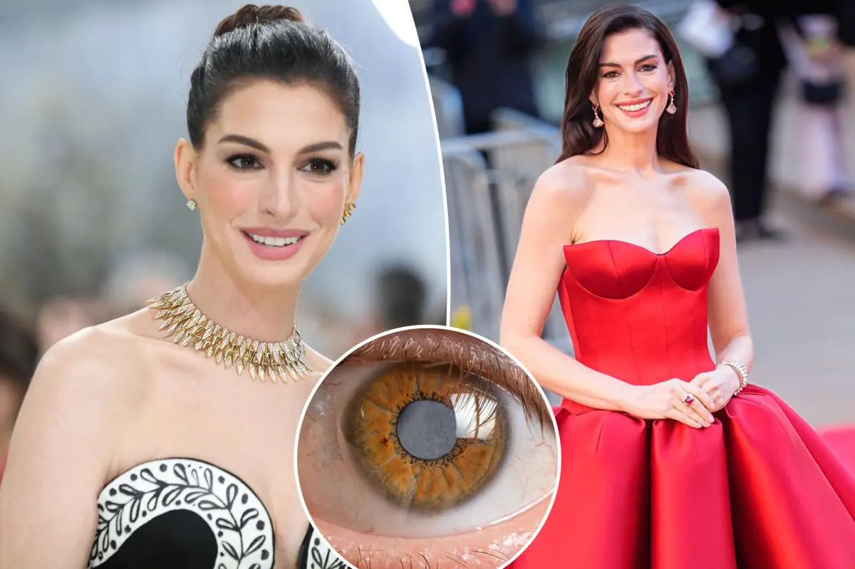 Anne Hathaway's hidden medical issue for ten years caused her significant vision loss during her 30s.
