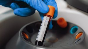 'Forever Chemicals' Detected in 98.8% of Blood Samples Analyzed