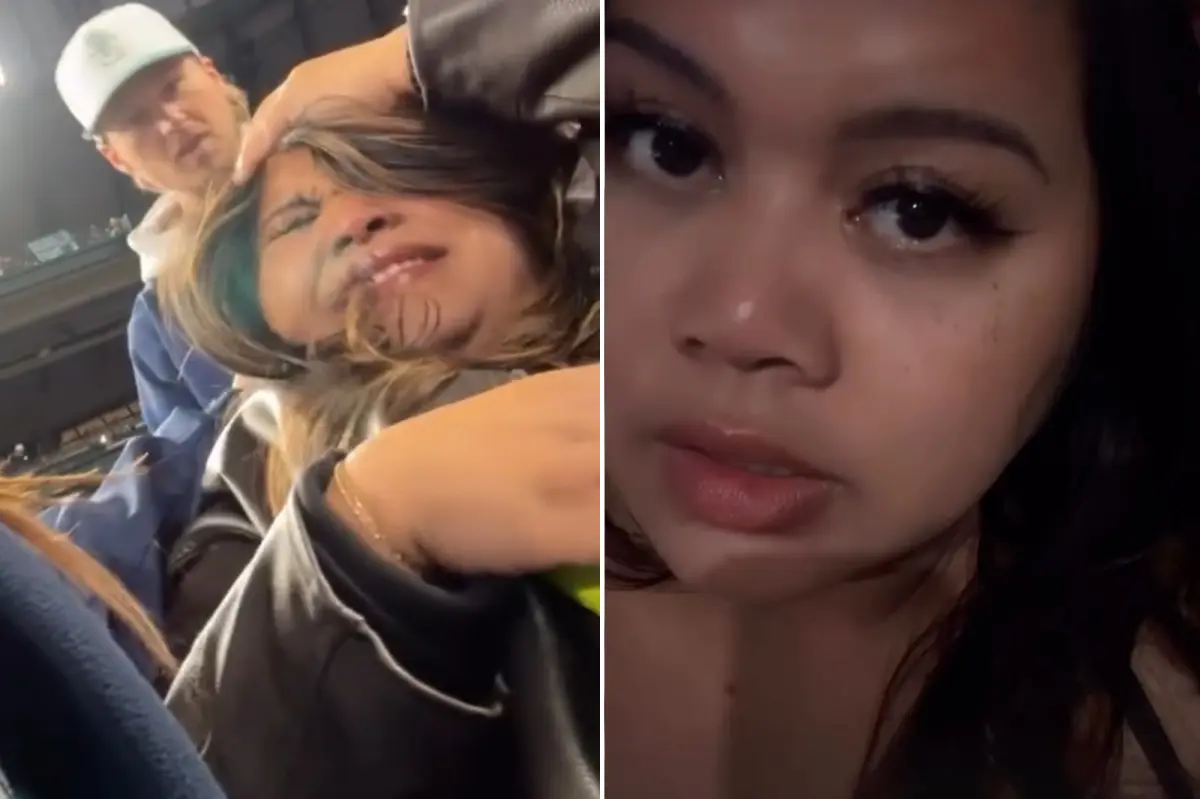 Foul ball that injured a woman's skull at a Padres game makes headlines worldwide