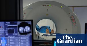 Gaining weight in adulthood can raise cancer risk by as much as five times, study finds