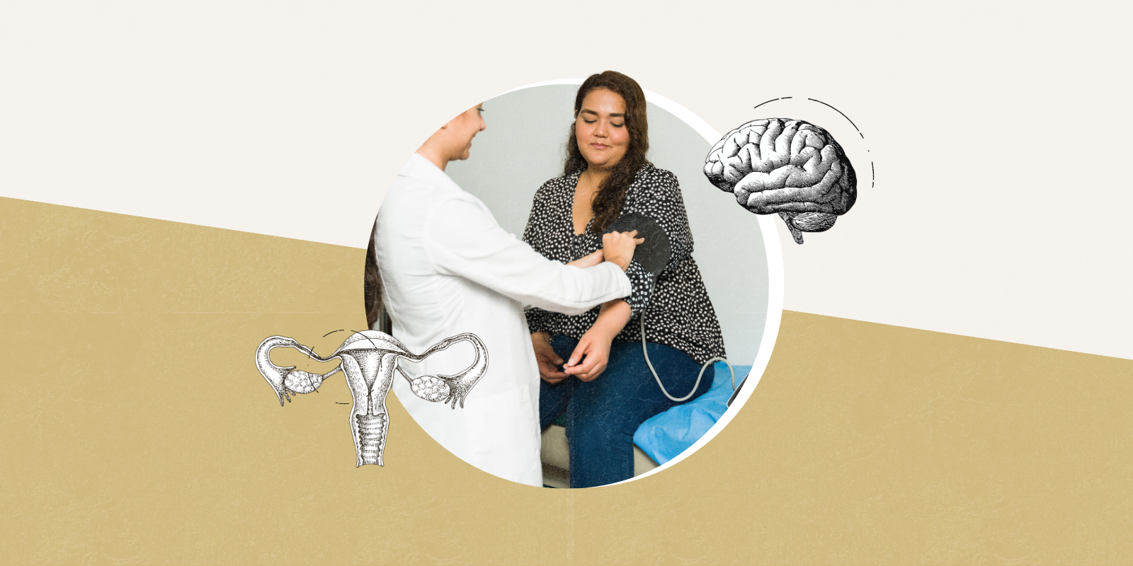 Global Experts Rename PCOS to Better Represent Its Multisystem Nature