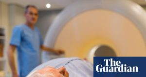 Global cancer care is at risk due to a shortage of 100 million workers, report indicates